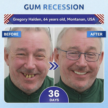 🦷PuraCure® Multi-Action Tooth & Gum Repair Mouthwash  | Collagen × Postbiotics × β-Glucanase