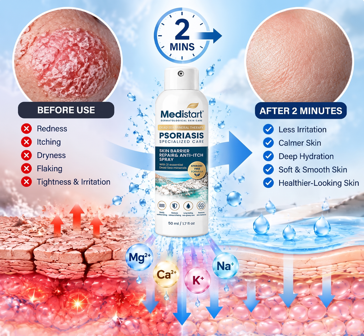 🌿🌿 Medistart® PSORIASIS SPECIALIZED SKIN CARE